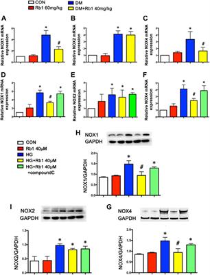 Ginsenoside Rb1 Ameliorates Diabetic Arterial Stiffening via AMPK Pathway